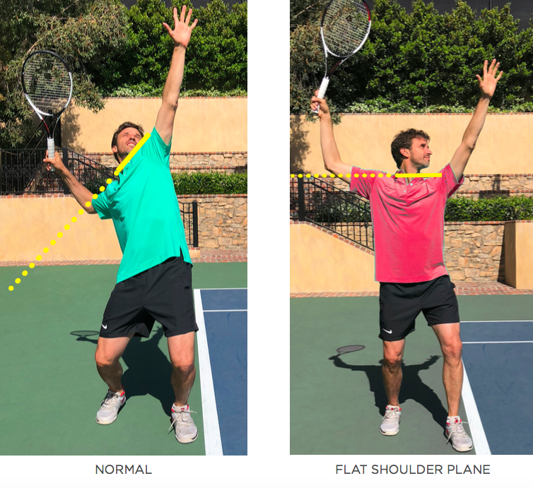 Thoracic Spine Mobility & Its impact on the Shoulder - TennisPrehabLab